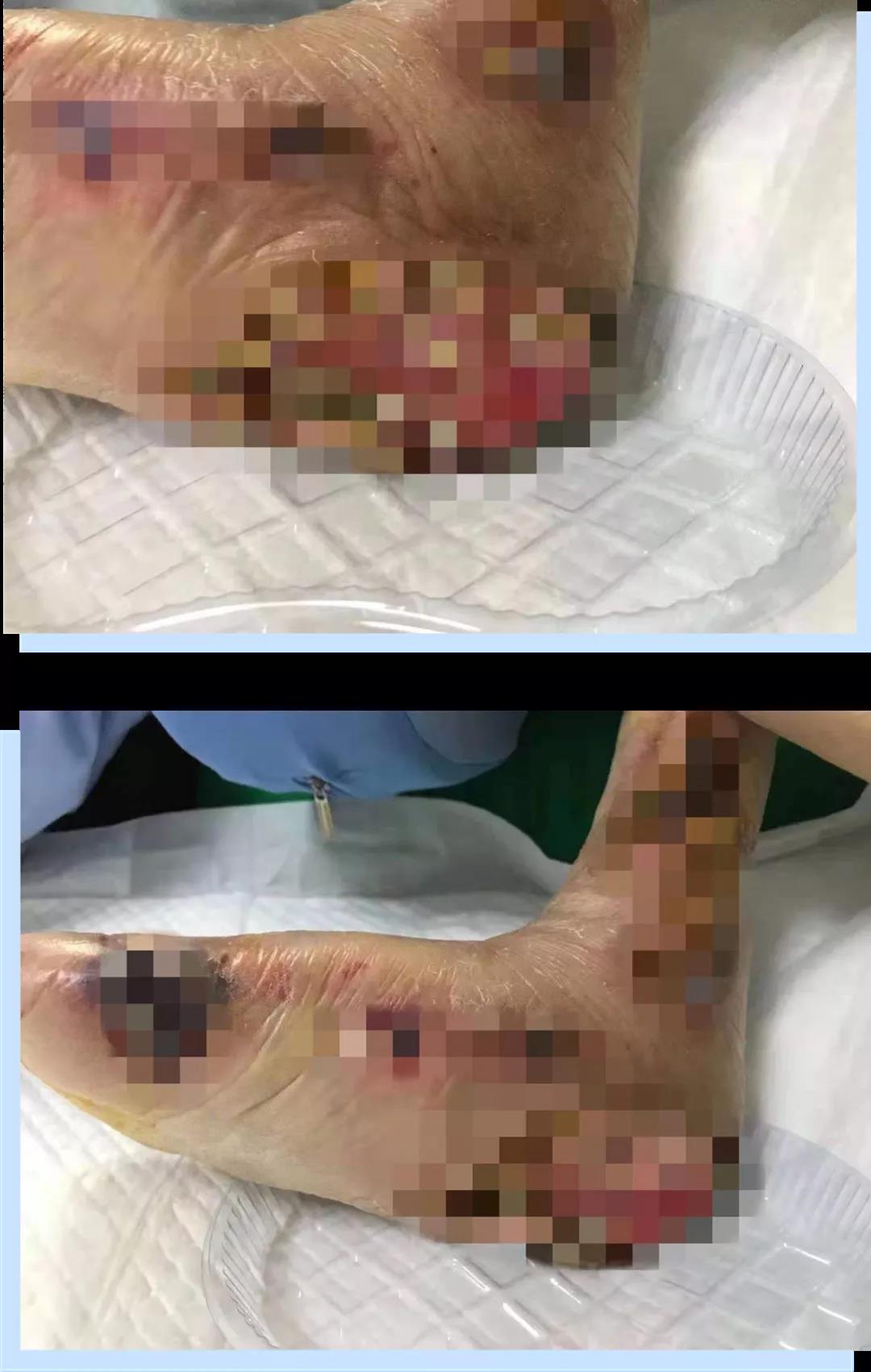 医患情深丨护理病房医护人员再获赞誉，家属感谢赠锦旗！