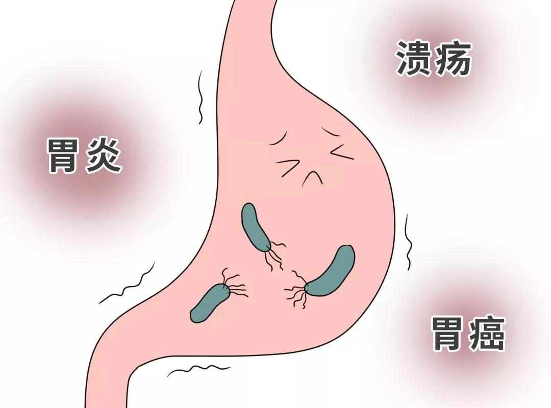 致癌？据明珠医院检验统计：每5人就有1个感染，该如何治疗？